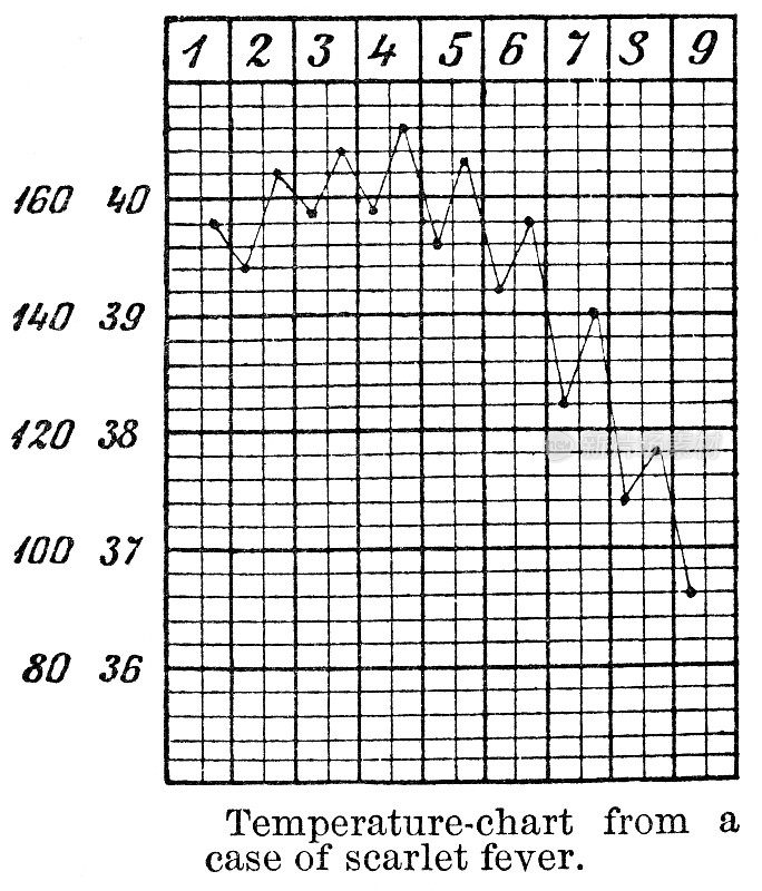 猩红热病人体温表- 19世纪